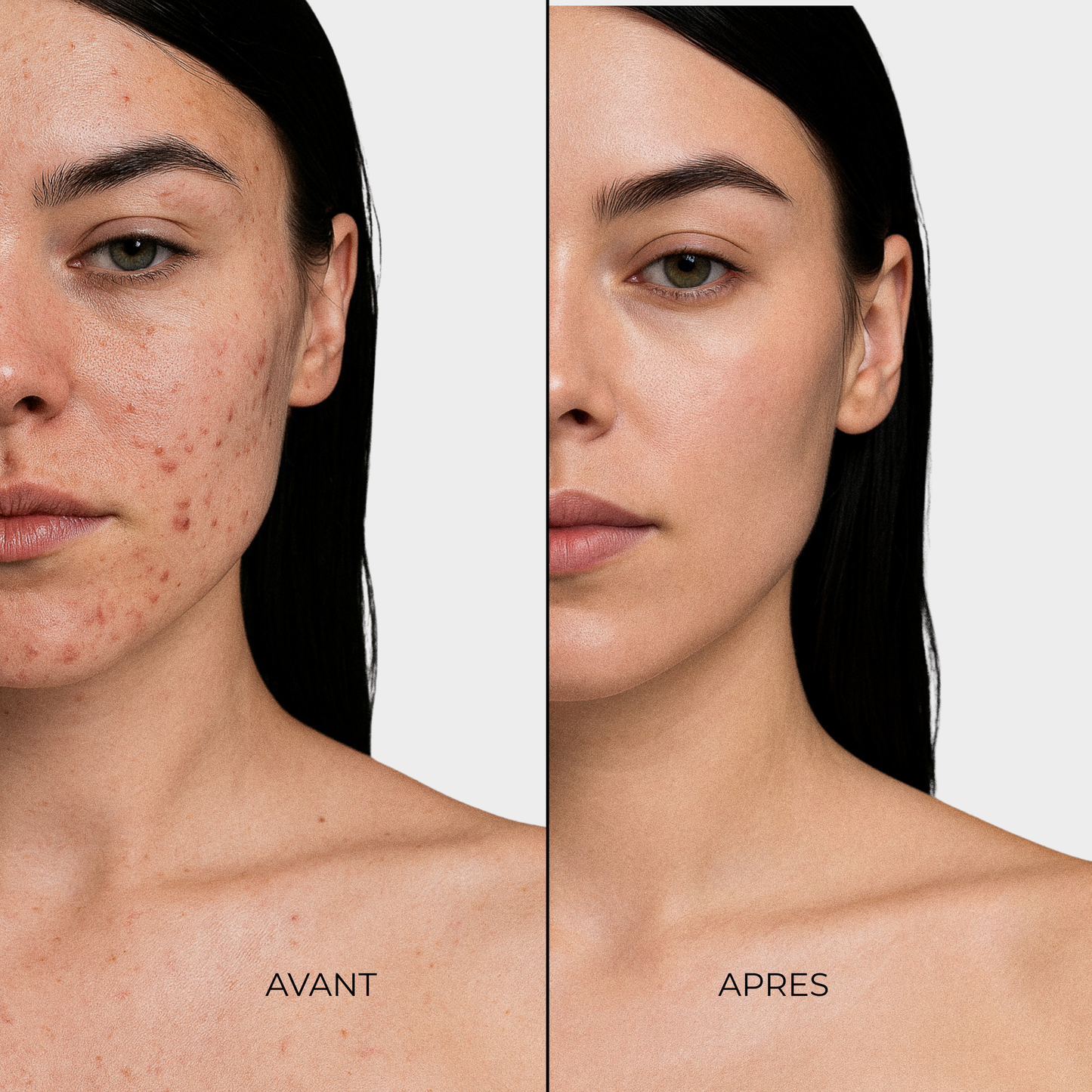 Routine Éclat & Teint Net