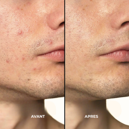 Gel Visage Équilibrant