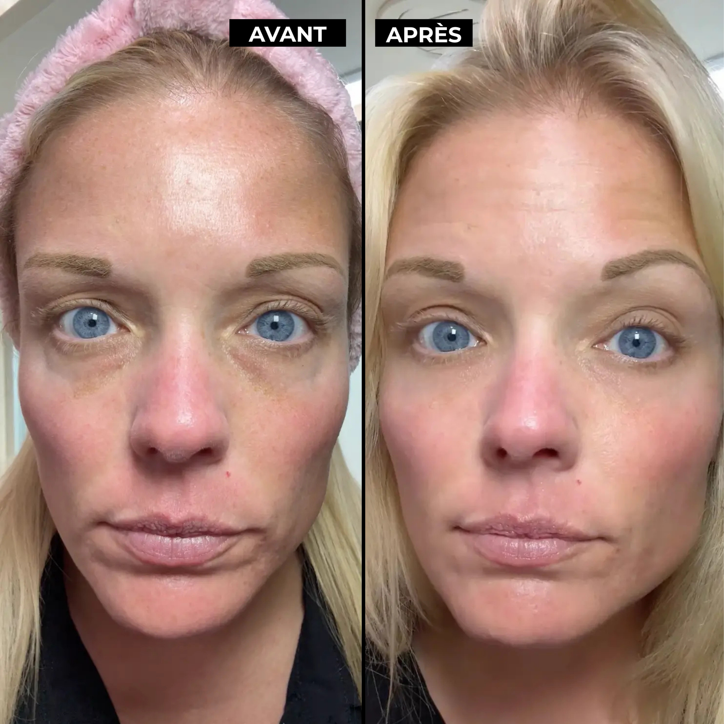 Crème Contour des Yeux 3-en-1
